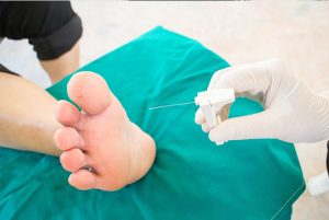 Neuropathy Relief Miami. ¿Síntomas, causas y tratamiento de la neuropatía sensorial? Esta condición puede ser causada por una variedad de factores, que incluyen diabetes, quimioterapia y ciertos medicamentos. En este blog, discutiremos qué es la neuropatía sensorial, sus síntomas, causas y opciones de tratamiento.