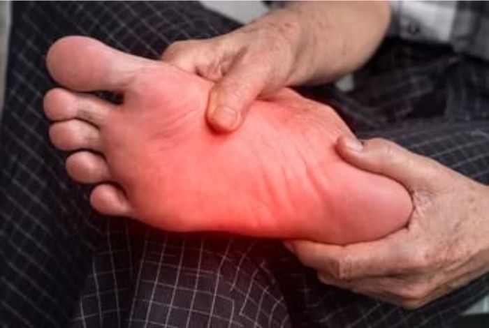 Neuropathy Relief Miami. Neuropatía diabética periférica: lo que necesita saber. La neuropatía diabética periférica (DPN, por sus siglas en inglés) es un tipo de daño nervioso que puede ocurrir en personas con diabetes.